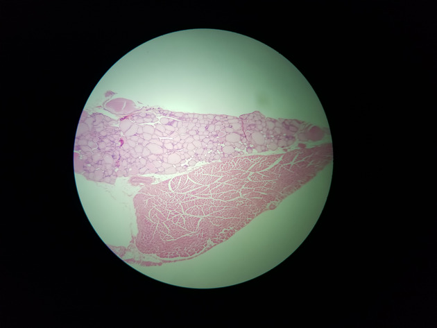 Parathyroid Thyroid Slides - Parathyroid_Thyroid 001 40X